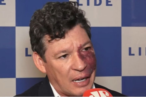 Deputados avaliam impacto da inclusão da carne na cesta básica desonerada